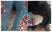 حمله سگ های ولگرد به یک جوان راوری +تصاویر