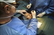 رتبه بیستم ایران در میزان عمل‌های جراحی پلاستیک در جهان/ایران رتبه اول در جراحی بینی